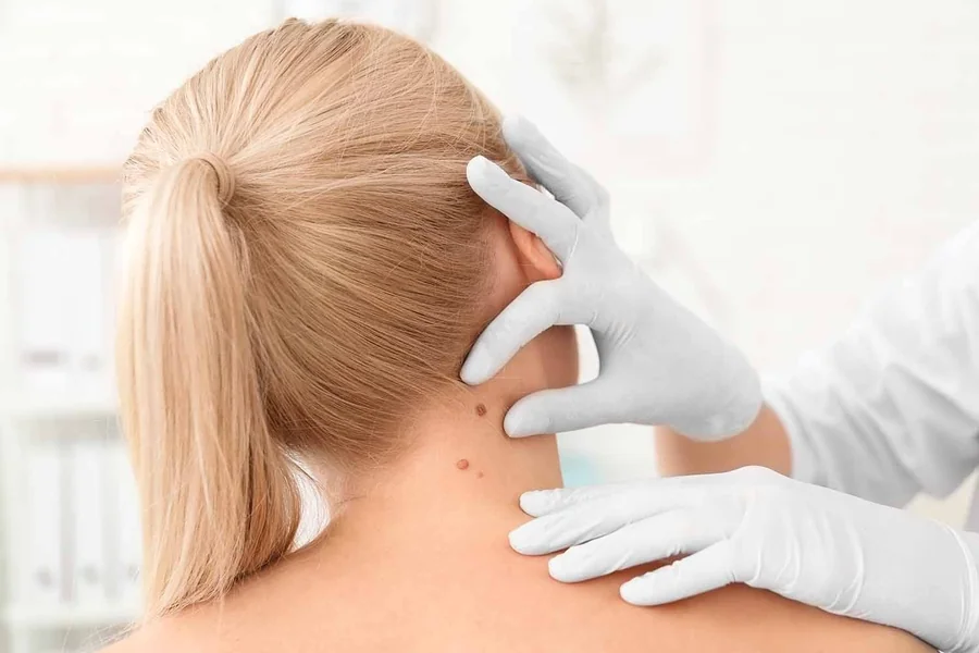 Skin Check