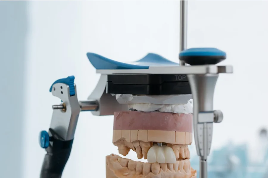 Dental Bridges