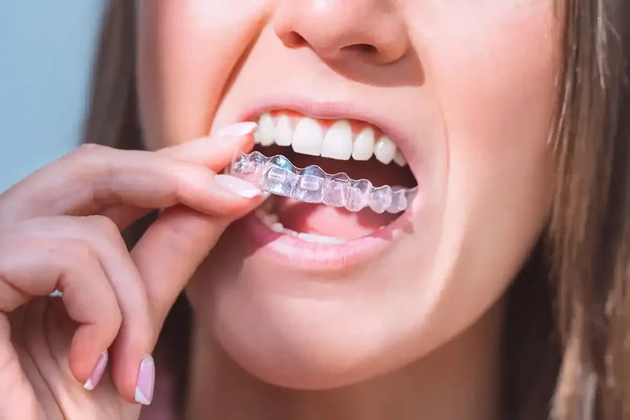 Teeth Aligners