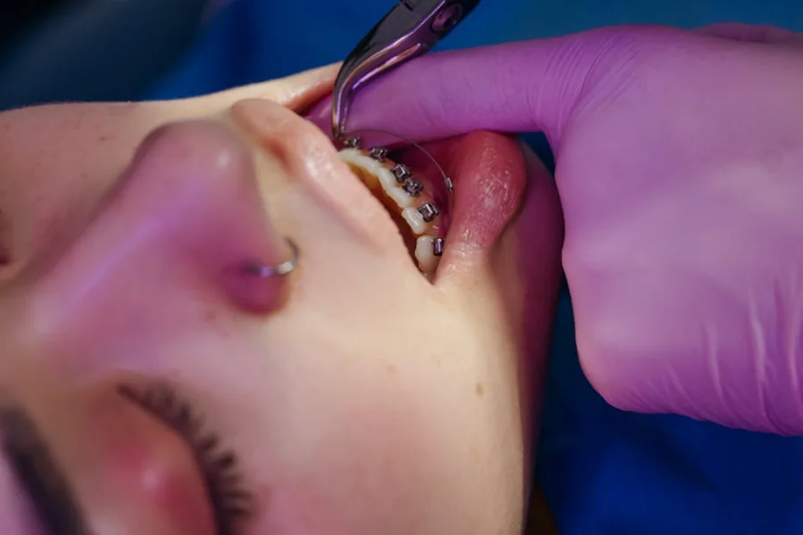 Need Orthodontic