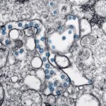 Cellular Therapy for Pain Management: A Comprehensive Look at Promising Innovations