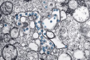 Cellular Therapy for Pain Management: A Comprehensive Look at Promising Innovations