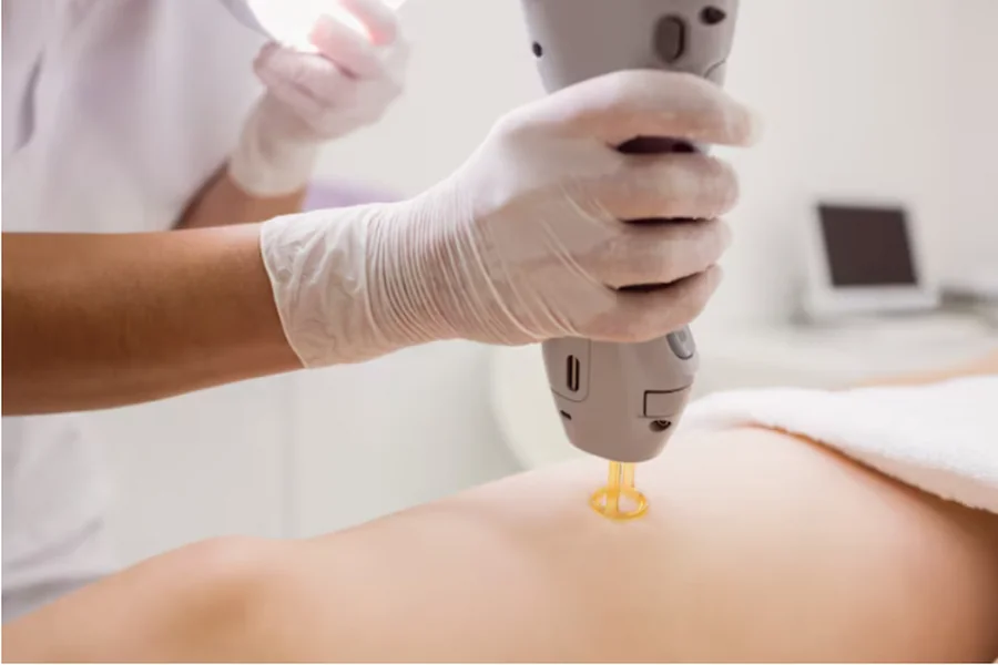 Skin Tag